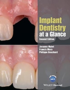عکس Implant Dentistry at a Glance