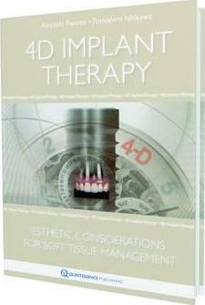 عکس 4D Implant Therapy : Esthetic Considerations for Soft Tissue Management