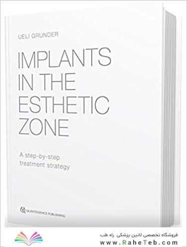 Implants in the Esthetic Zone : A Step-by-Step Treatment Strategy