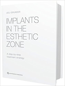 عکس Implants in the Esthetic Zone : A Step-by-Step Treatment Strategy