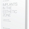 Implants in the Esthetic Zone : A Step-by-Step Treatment Strategy