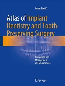 عکس Atlas of Implant Dentistry and Tooth-Preserving Surgery : Prevention and Management of Complications