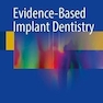 Evidence-Based Implant Dentistry