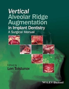 عکس Vertical Alveolar Ridge Augmentation in Implant Dentistry : A Surgical Manual