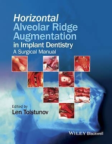 عکس Horizontal Alveolar Ridge Augmentation in Implant Dentistry : A Surgical Manual