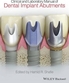 عکس Clinical and Laboratory Manual of Dental Implant Abutments