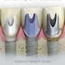Clinical and Laboratory Manual of Dental Implant Abutments