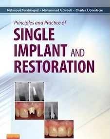 عکس Principles and Practice of Single Implant and Restoration