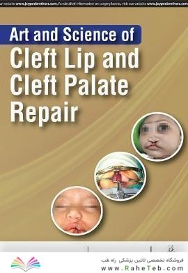 Art and Science of Cleft Lip and Cleft Palate Repair