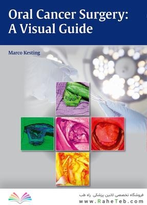 Oral Cancer Surgery : A Visual Guide