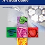 Oral Cancer Surgery : A Visual Guide