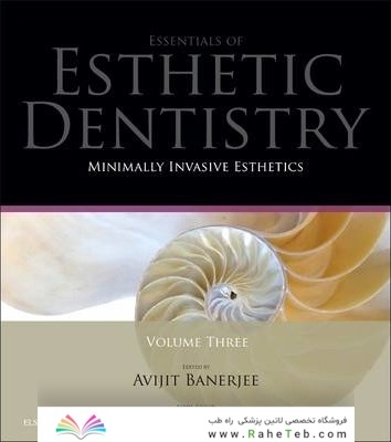 Minimally Invasive Esthetics : Essentials in Esthetic Dentistry Series