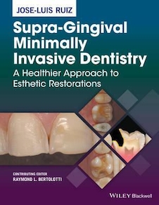 عکس Supra-Gingival Minimally Invasive Dentistry