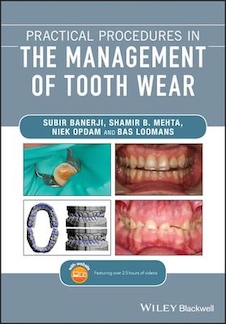 عکس Practical Procedures in the Management of Tooth Wear