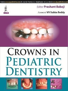 عکس Crowns in Pediatric Dentistry