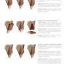 Traumatic Dental Injuries : A Manual