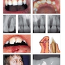 Traumatic Dental Injuries : A Manual