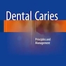 Dental Caries2016