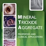 Mineral Trioxide Aggregate
