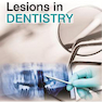 Mucocutaneous Lesions in Dentistry