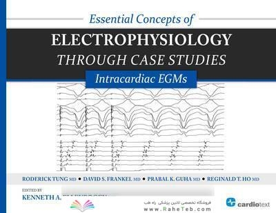 Essential Concepts of Electrophysiology Through Case Studies2015