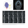 Atlas of Cone Beam Computed Tomography 2022