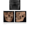 Atlas of Cone Beam Computed Tomography 2022