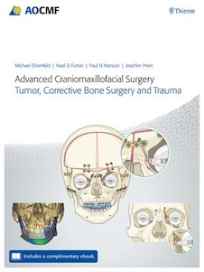 عکس Advanced Craniomaxillofacial Surgery : Tumor, Corrective Bone Surgery, and Trauma 2020