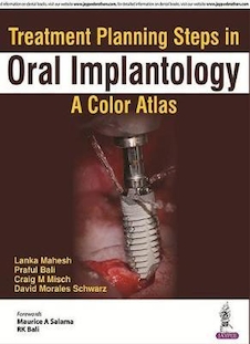 عکس Treatment Planning Steps in Oral Implantology 2018