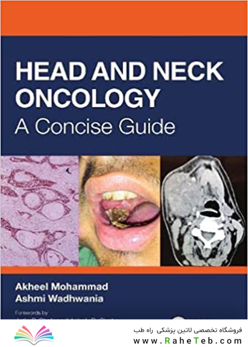 Head and Neck Oncology: A Concise Guide 1st Edición