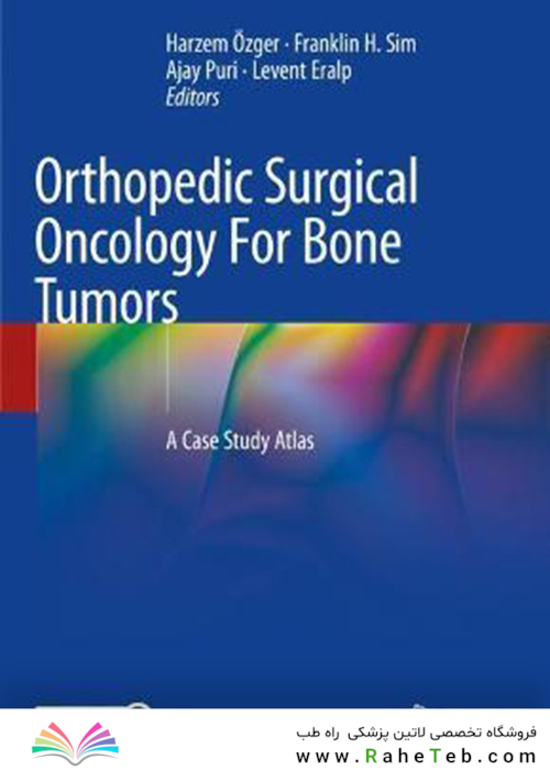 Orthopedic Surgical Oncology For Bone Tumors