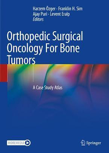عکس Orthopedic Surgical Oncology For Bone Tumors