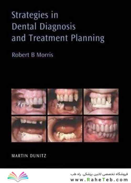 Strategies in Dental Diagnosis and Treatment Planning