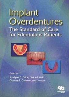 عکس Implant Overdentures as the Standard of Care for Edentulous Patients