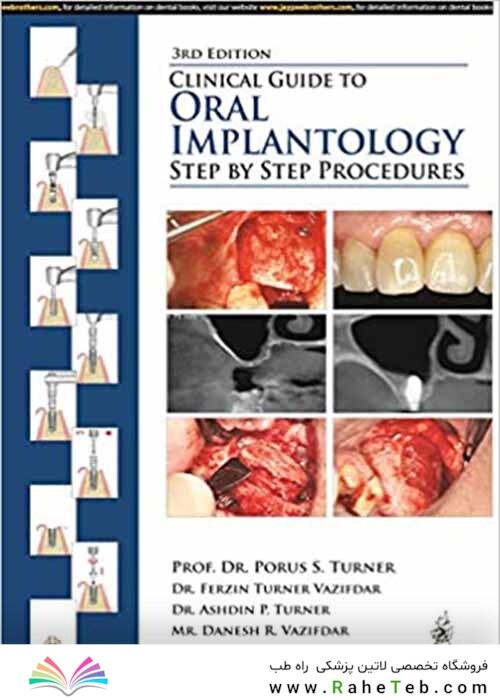 Clinical Guide to Oral Implantology: Step by Step Procedures 3rd Edition