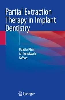عکس Partial Extraction Therapy in Implant Dentistry