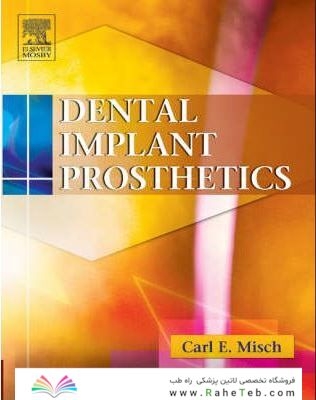 Dental Implant Prosthetics
