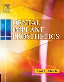 عکس Dental Implant Prosthetics