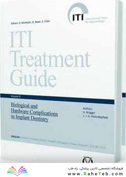 ITI Treatment Guide: Biological and Hardware Complications in Implant Dentistry: 8
