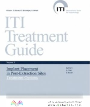 ITI Treatment Guide: Implant Placement in Post-extraction Sites: Treatment Options 3