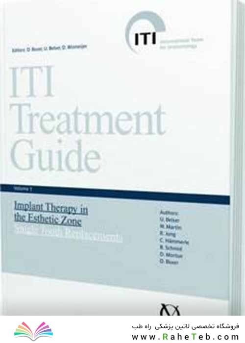 ITI Treatment Guide: Implant Therapy in the Esthetic Zone - Single-tooth Replacements v. 1