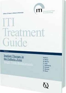 عکس ITI Treatment Guide: Implant Therapy in the Esthetic Zone - Single-tooth Replacements v. 1