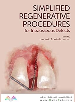 Simplified Regenerative Procedures for Intraosseous Defects