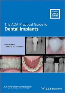 عکس The ADA Practical Guide to Dental Implants 2021