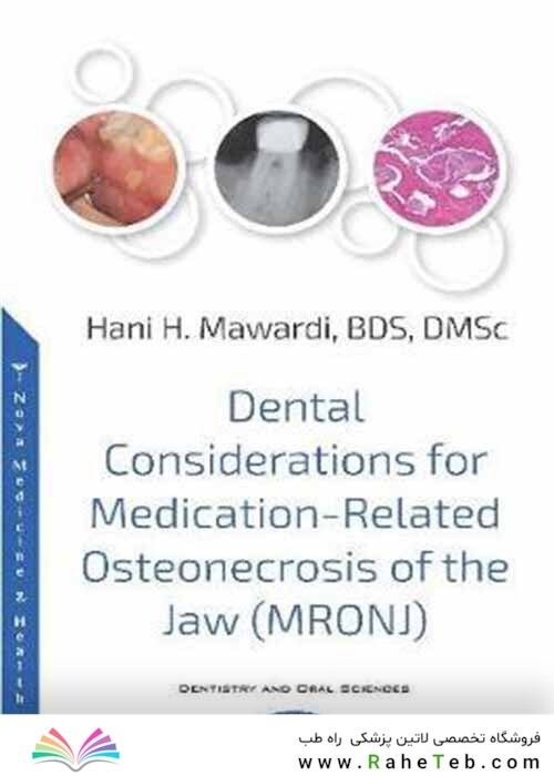 Dental Considerations for Medication-Related Osteonecrosis of the Jaw (MRONJ)
