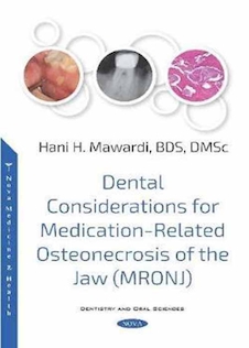 عکس Dental Considerations for Medication-Related Osteonecrosis of the Jaw (MRONJ)
