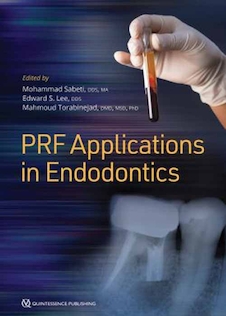 عکس Platelet-Rich Fibrin Prf Applications in Endodontics