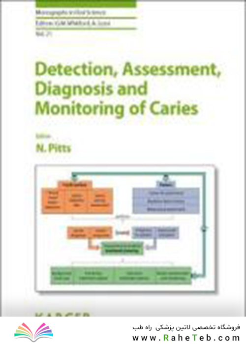 Detection, Assessment, Diagnosis and Monitoring of Caries