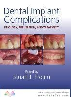 Dental Implant Complications