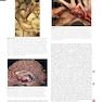 Youmans and Winn Neurological Surgery: 4 - Volume Set 2023